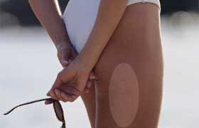 12 moyens pour combattre la cellulite