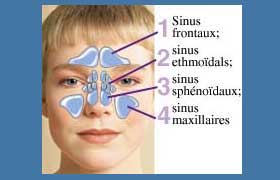 La sinusite: La traiter en douceur par les soins naturels. 